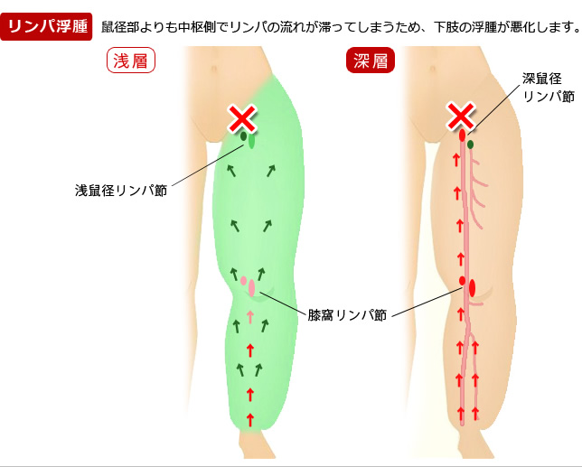 下肢のリンパの流れの図