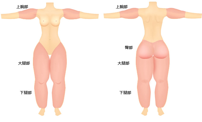 リンパ浮腫 脂肪性浮腫の改善 美容外科 ｋｕｎｏクリニック 東京銀座 大阪梅田